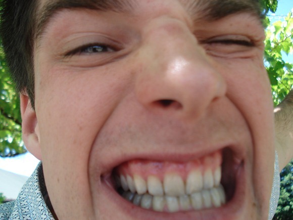 The everlasting purple teeth