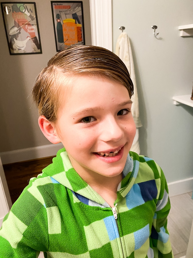 Mazey lost his front tooth!!