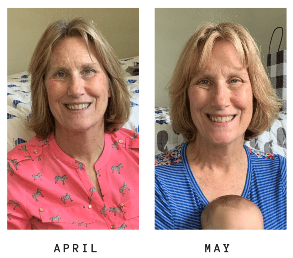 Beautycounter Before & After
